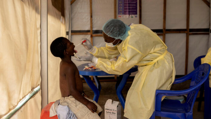 2024-07-24T083712Z_837774522_RC2YX8AVV8O1_RTRMADP_3_HEALTH-MPOX-CONGO.JPG